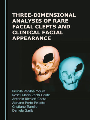 cover image of Three-Dimensional Analysis of Rare Facial Clefts and Clinical Facial Appearance